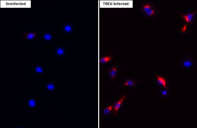 Anti-Tick-borne encephalitis virus (TBEV) Envelope antibody [HL4033] used in Immunocytochemistry/ Immunofluorescence (ICC/IF). GTX642364